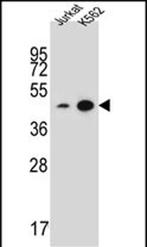 PHF21B Antibody (Center)