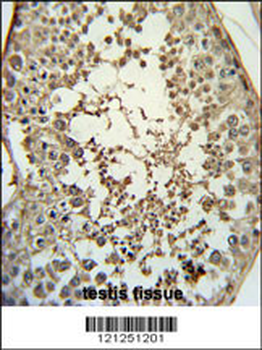 PMCH Antibody (Center)