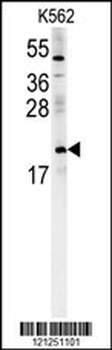 PMCH Antibody (Center)