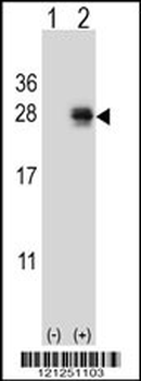 PMCH Antibody (Center)