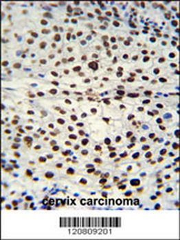 HNRPAB Antibody (N-term)