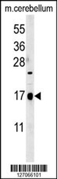 CA095 Antibody (C-term)