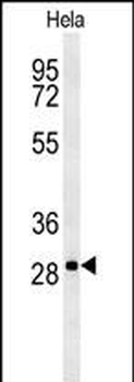 TM165 Antibody (N-term)