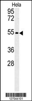 KLF17 Antibody (C-term)
