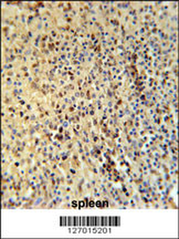 SPT13 Antibody (Center)
