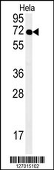SPT13 Antibody (Center)