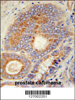 HHAT Antibody (N-term)