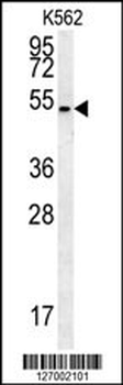 HHAT Antibody (N-term)