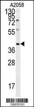 CD99L2 Antibody (Center)