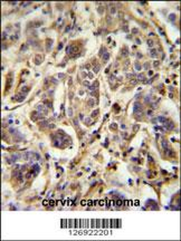FLJ11506 Antibody (C-term)