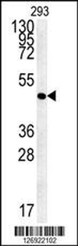 FLJ11506 Antibody (C-term)
