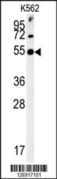 SYT13 Antibody (N-term)