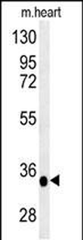 PRB2 Antibody (C-term)