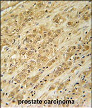 DKC1 Antibody (Center)