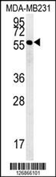RAB11FIP2 Antibody (Center)