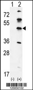 GKAP1 Antibody (C-term)