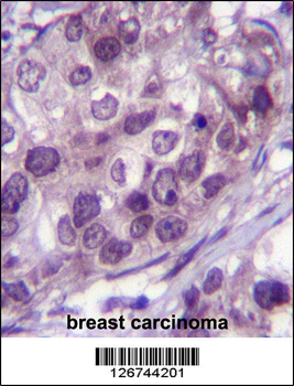 NR3C1 Antibody (Center)
