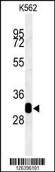 RDH16 Antibody (N-term)