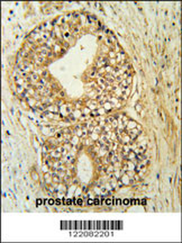 ATP11C Antibody (Center)