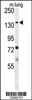 ATP11C Antibody (Center)