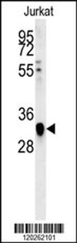 TFAP4 Antibody (C-term)