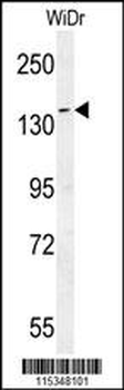 DAAM1-T361 Antibody (N-term)
