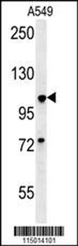 BUB1A Antibody (N-term)