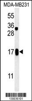SMIM14 Antibody (C-term)