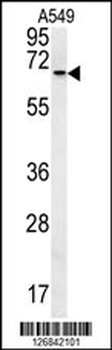 DHX58 Antibody (N-term)