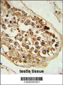 DEPDC1 Antibody (N-term)