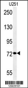 DEPDC1 Antibody (N-term)