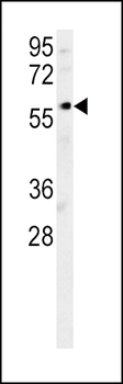 DCLRE1B Antibody (Center)