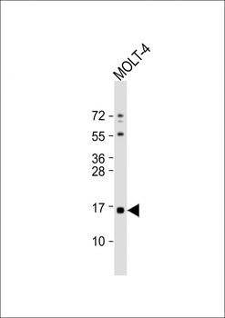 CRABP1 Antibody (C-term)