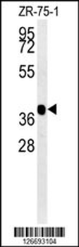 NIPAL2 Antibody (N-term)