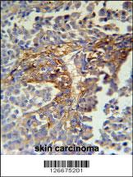ARMC5 Antibody (C-term)