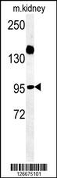 ARMC5 Antibody (C-term)