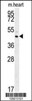 TAMM41 Antibody (Center)