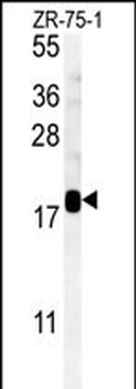 SDHAF1 Antibody (Center)