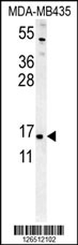 ENY2 Antibody (N-term)