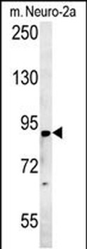 ST18 Antibody (N-term)
