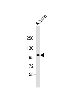 ST18 Antibody (N-term)