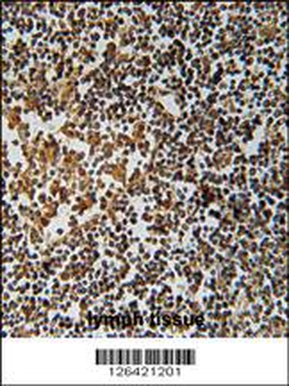 PYHIN1 Antibody (N-term)