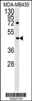 PYHIN1 Antibody (N-term)