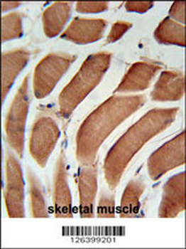 SIKE Antibody (C-term)