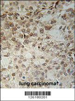 IFT43 Antibody (Center)