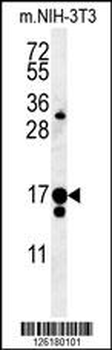 IFT43 Antibody (Center)