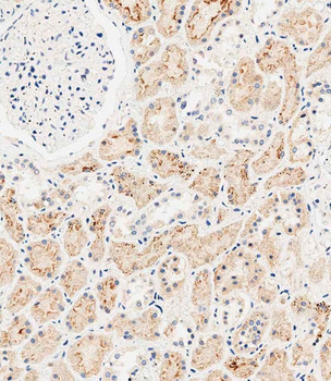SLC47A1 Antibody (C-term)