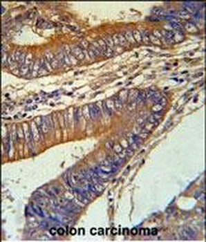 KLC3 Antibody (Center)