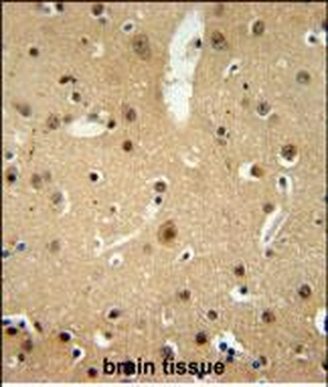NMB Antibody (Center)