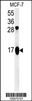 ATP5J2 Antibody (Center)